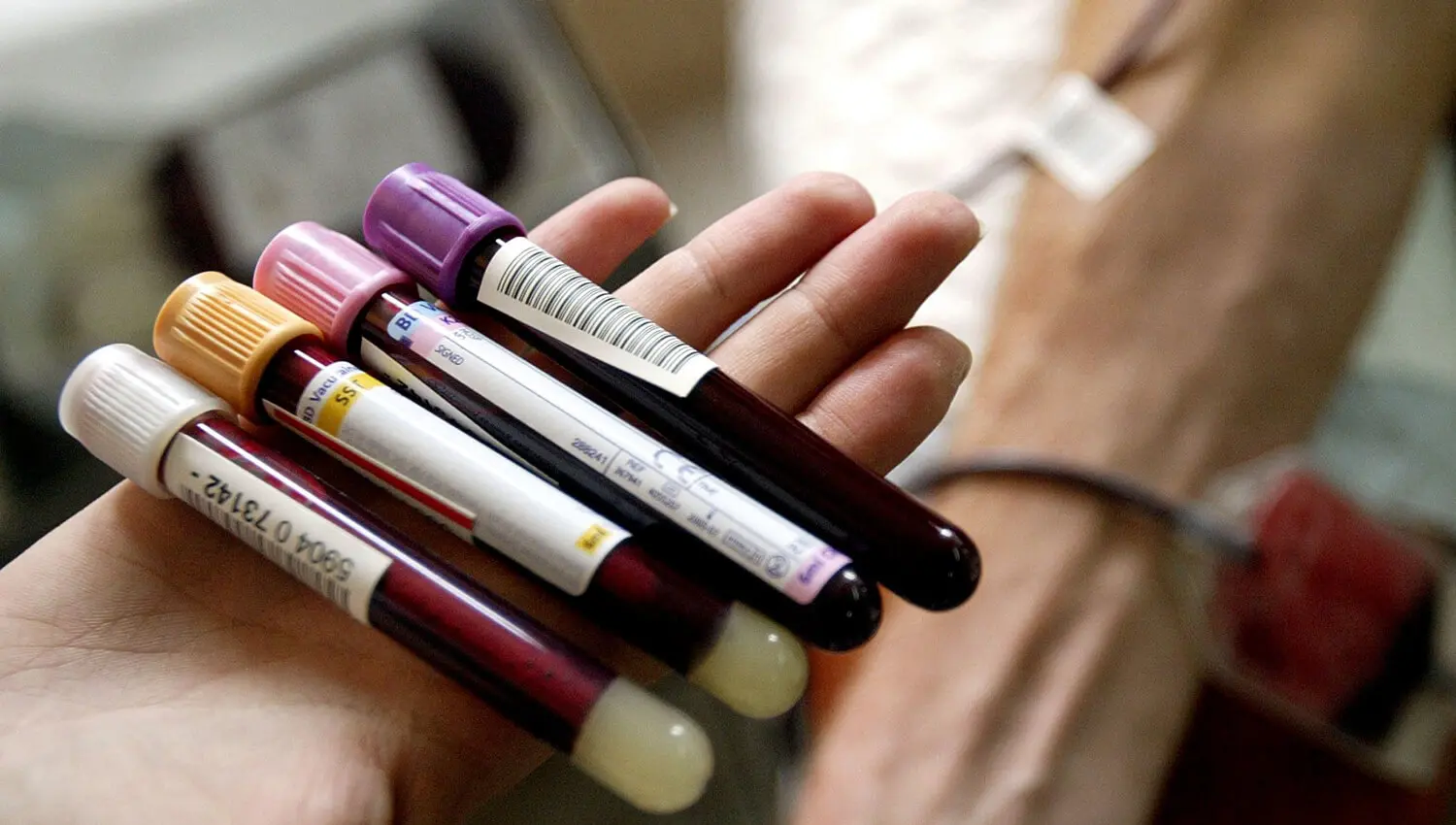 In einer offenen Hand liegen 4 Röhrchen mit Blut von einer Blutspende.
