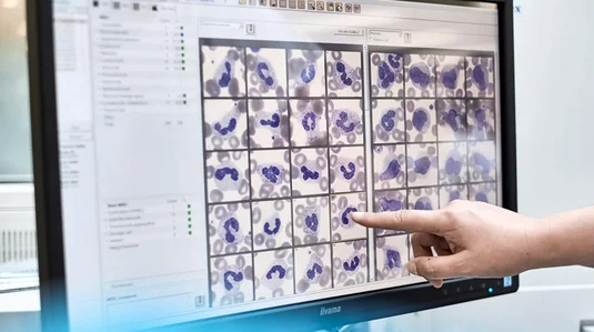 Vergrössern: Finger zeigt auf einen Blutscan am Bildschirm
