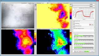 Das Bild zeigt eine Bildschirmfoto der DermoInspect Software