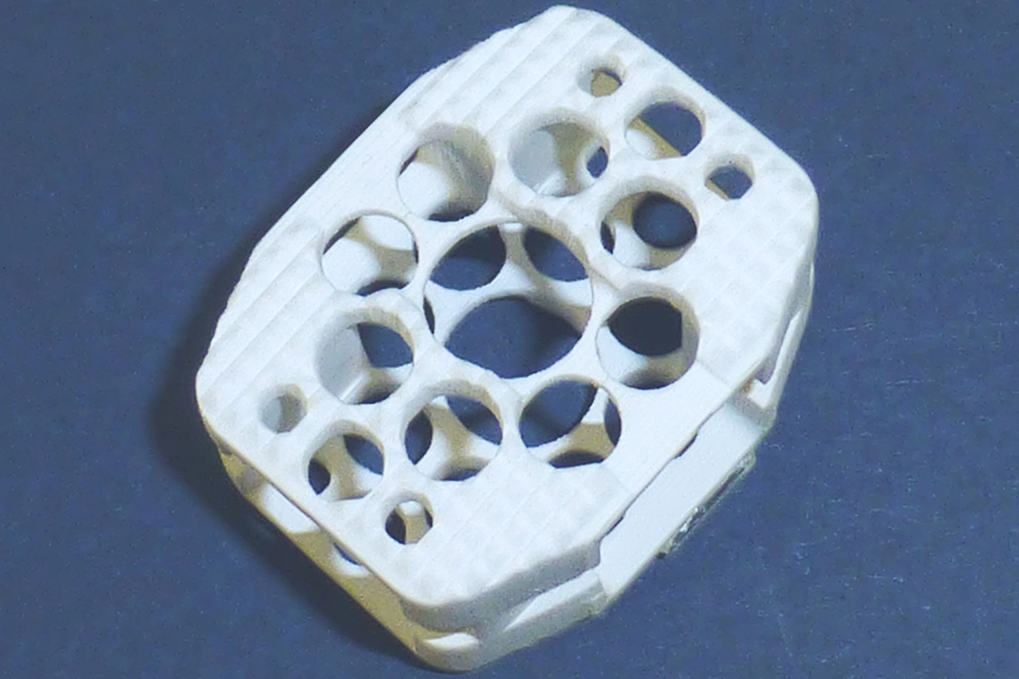 Intervertebral disc cage study, aluminium oxide-ceramic, stereolithography