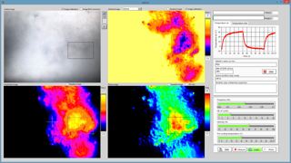 Das Bild zeigt eine Bildschirmfoto der DermoInspect Software