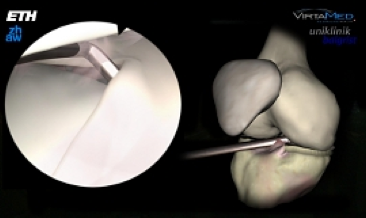 Bild einer simulierten Operation am Knie: Blick durch das Endoskop (links) und Röntgenblick (rechts)