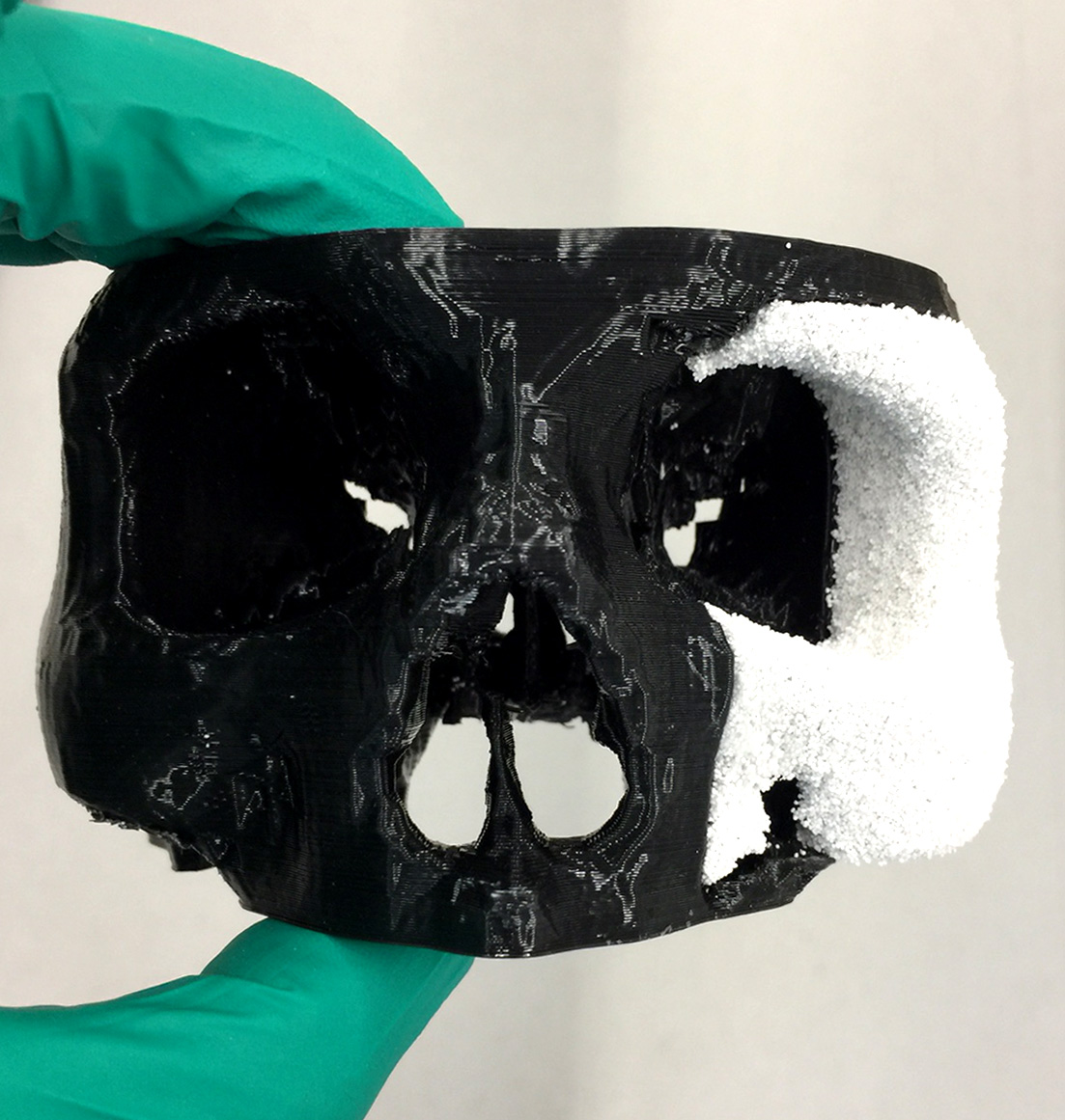 Phil: 3D gedrucktes Modellimplantat eines Jochbeins in weiss. Modell des Schädels in schwarz wurde mit der FDM-Technologie gedruckt.