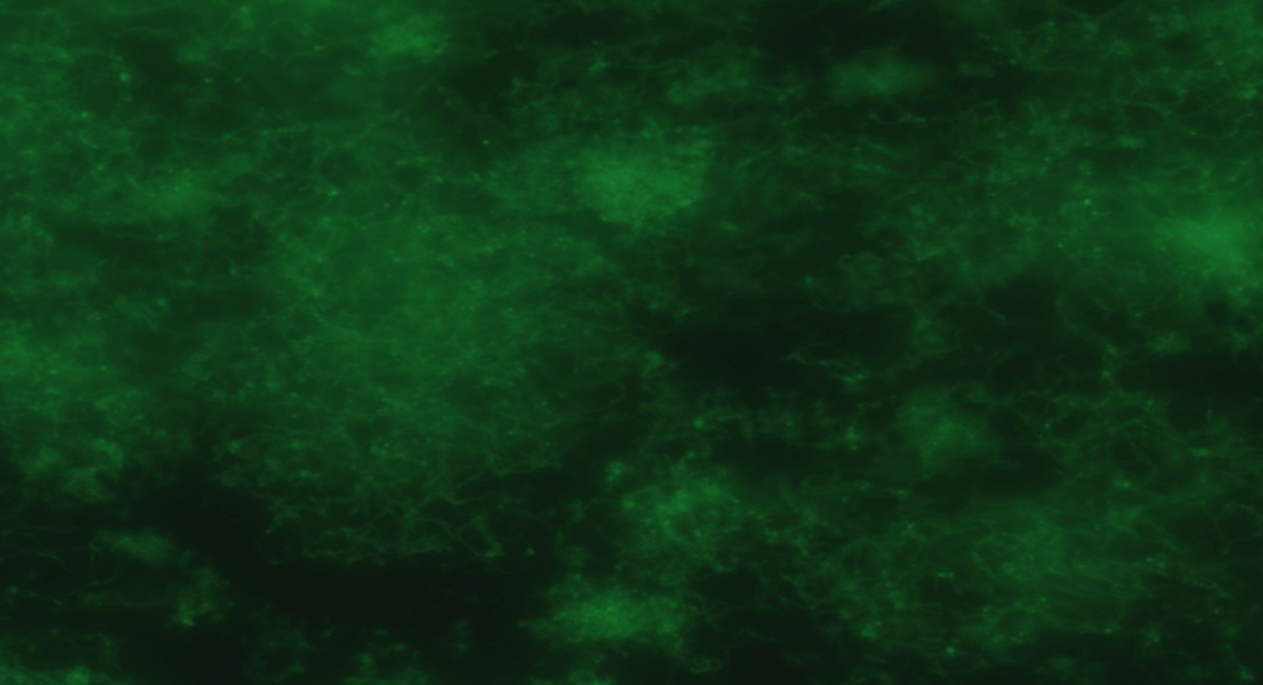Mikroskopische Aufnahme (grün fluoreszierend) eines Biofilms gebildet von E. coli 