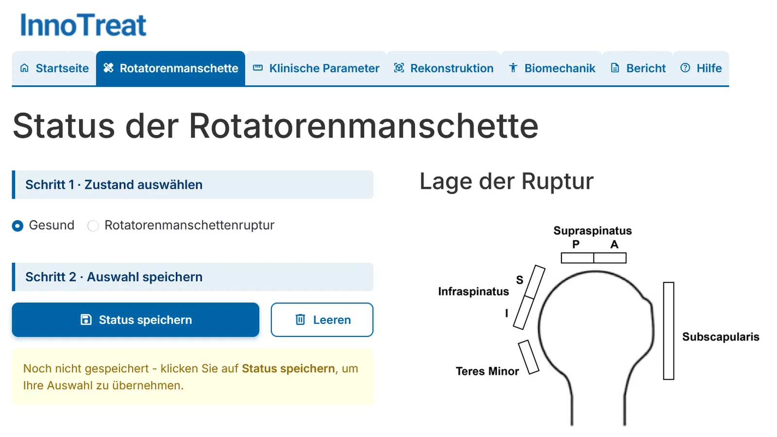 Home page of the Shoulder Reconstruction Tool: Rotator cuff status
